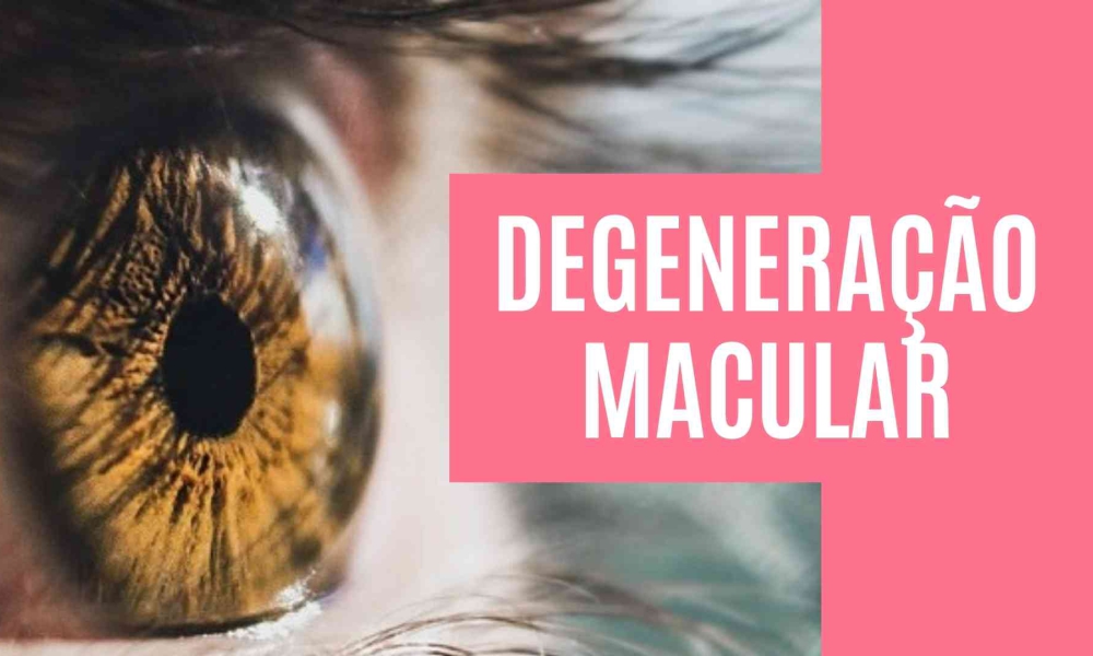 Degeneração Macular Relacionada a Idade 